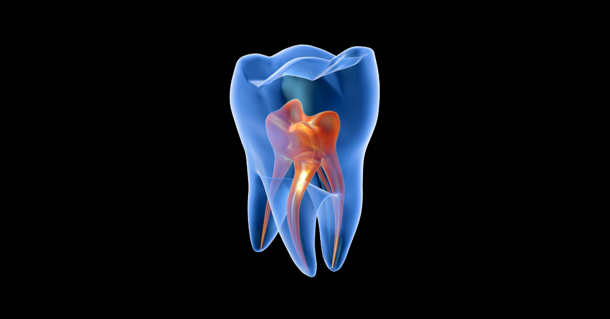 ¿Sabes qué es la cirugía apical y cuándo se recurre a ella?